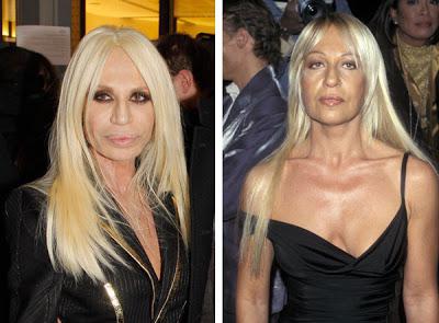 Donatella Versace (biografi). Hur hennes utseende förändrades efter plast