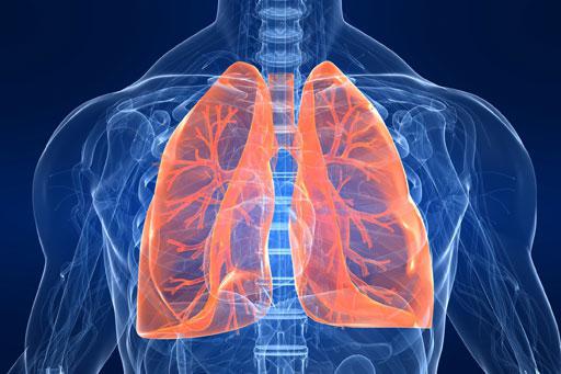 Obstruktiv bronkit: symptom och behandling, orsaker till sjukdomen