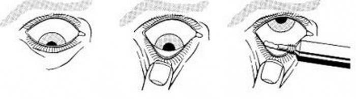 tetracyklin ögonsalva