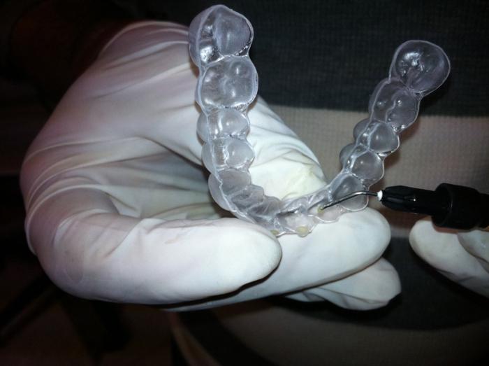 Tandjustering i ortodonti